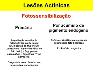 Lesões Actínicas Fotossensibilização Primária Por acúmulo de pigmento endógeno Ingestão de substância fotodinâmica pré-formada Ex. ingestão de  Hypericum perforatum - hipericina  (Erva de São João) e  Fagopyrum esculentum – fagopirina (Trigo Sarraceno) Drogas tais como fenotiazina, tetraciclina, sulfonamida Defeito enzimático na síntese de substâncias fotodinâmicas Ex. Porfiria congênita 