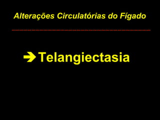 Alterações Circulatórias do Fígado  Telangiectasia 