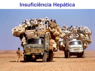 Insuficiência Hepática 
