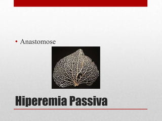 Hiperemia Passiva
• Anastomose
 