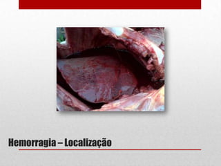 Hemorragia – Localização
 