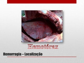 Hemorragia – Localização
 