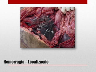 Hemorragia – Localização
 