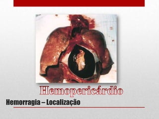 Hemorragia – Localização
 