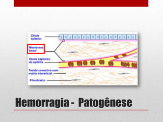 Hemorragia - Patogênese
 