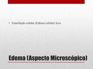 Edema (Aspecto Microscópico)
• Tumefação celular (Edema celular) leve
 