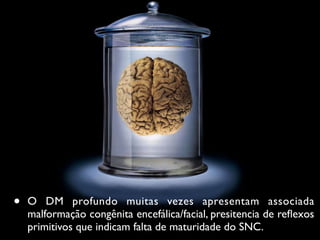 •   O DM profundo muitas vezes apresentam associada
    malformação congênita encefálica/facial, presitencia de reﬂexos
    primitivos que indicam falta de maturidade do SNC.
 