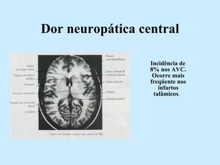 Dor neuropática central Incidência de 8% nos AVC. Ocorre mais freqüente nos infartos talâmicos .  