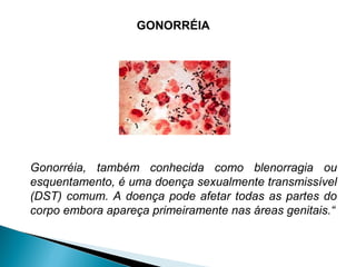 GONORRÉIA
Gonorréia, também conhecida como blenorragia ou
esquentamento, é uma doença sexualmente transmissível
(DST) comum. A doença pode afetar todas as partes do
corpo embora apareça primeiramente nas áreas genitais.“
 