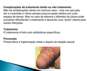 Complicações do tratamento tardio ou não tratamento:
Não há complicações sérias em nenhum sexo , uma vez que pela
dor e incomodo a vítima sempre procura ajuda médico em curto
espaço de tempo. Mas no caso de demora o diâmetro da úlcera pode
aumentar dificultando o tratamento e deixando uma "porta" aberta para
outras infecções.
Tratamento
O tratamento é feito com antibióticos específicos.
Prevenção
Preservativo e higienização antes e depois da relação sexual
 