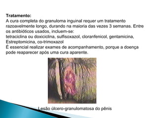 Tratamento:
A cura completa do granuloma inguinal requer um tratamento
razoavelmente longo, durando na maioria das vezes 3 semanas. Entre
os antibióticos usados, incluem-se:
tetraciclina ou doxiciclina, sulfisoxazol, cloranfenicol, gentamicina,
Estreptomicina, co-trimoxazol
É essencial realizar exames de acompanhamento, porque a doença
pode reaparecer após uma cura aparente.
Lesão úlcero-granulomatosa do pênis
 