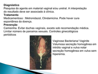 Diagnóstico
Pesquisa do agente em material vaginal e/ou uretral. A interpretação
do resultado deve ser associado à clínica.
Tratamento
Medicamentoso : Metronidazol, Clindamicina. Pode haver cura
espontânea da doença.
Prevenção
Camisinha. Evitar duchas vaginais, exceto sob recomendação médica.
Limitar número de parceiros sexuais. Controles ginecológicos
periódicos
Vaginose Bacteriana/ Vaginite
Volumosa secreção homogênea em
intróito vaginal e vulva notar
secreção homogênea em vulva sem
hiperemia.
 