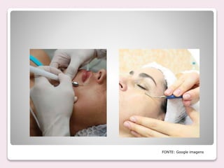 FONTE: Google imagens
 