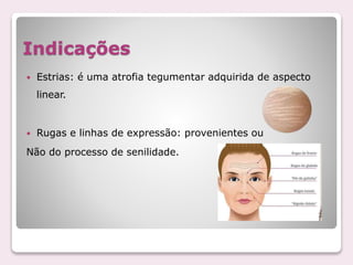 Indicações
 Estrias: é uma atrofia tegumentar adquirida de aspecto
linear.
 Rugas e linhas de expressão: provenientes ou
Não do processo de senilidade.
 