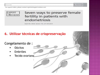 6. Utilizar técnicas de criopreservação
Congelamento de :
 Oócitos
 Embriões
 Tecido ovariano
 