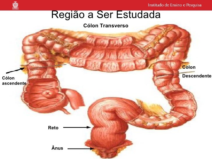 Exame enema opaco