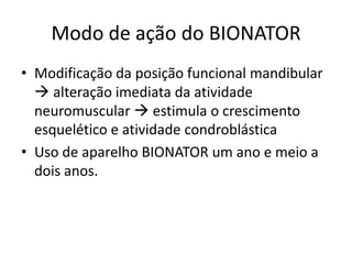 Modo de ação do BIONATORModificação da posição funcional mandibular  alteração imediata da atividade neuromuscular  estimula o crescimento esquelético e atividade condroblásticaUso de aparelho BIONATOR um ano e meio a dois anos.