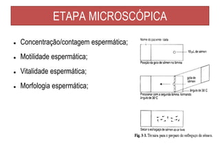 ETAPA MICROSCÓPICA
● Concentração/contagem espermática;
● Motilidade espermática;
● Vitalidade espermática;
● Morfologia espermática;
 