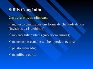 Sífilis CongênitaSífilis Congênita
Características clínicas:Características clínicas:
 incisivos chanfrados em forma de chave-de-fendaincisivos chanfrados em forma de chave-de-fenda
(incisivos de Hutchinon);(incisivos de Hutchinon);
 molares tuberculares (molar em amora);molares tuberculares (molar em amora);
 manchas no esmalte também podem ocorrer;manchas no esmalte também podem ocorrer;
 palato arqueado;palato arqueado;
 mandíbula curta.mandíbula curta.
 