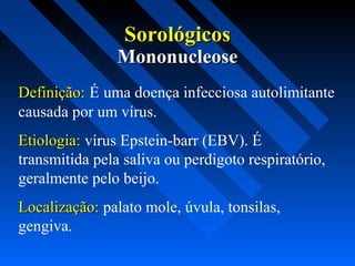 SorológicosSorológicos
Definição:Definição: É uma doença infecciosa autolimitante
causada por um vírus.
Etiologia:Etiologia: vírus Epstein-barr (EBV). É
transmitida pela saliva ou perdigoto respiratório,
geralmente pelo beijo.
Localização:Localização: palato mole, úvula, tonsilas,
gengiva.
MononucleoseMononucleose
 