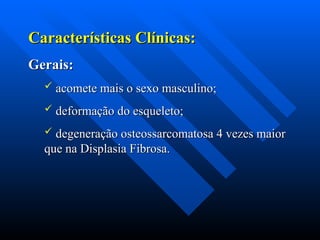 Características Clínicas:
Características Clínicas:
Gerais:
Gerais:
 acomete mais o sexo masculino;
acomete mais o sexo masculino;
 deformação do esqueleto;
deformação do esqueleto;
 degeneração osteossarcomatosa 4 vezes maior
degeneração osteossarcomatosa 4 vezes maior
que na Displasia Fibrosa.
que na Displasia Fibrosa.
 