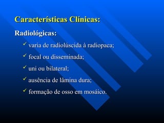 Características Clínicas:
Características Clínicas:
Radiológicas:
Radiológicas:
 varia de radiolúscida à radiopaca;
varia de radiolúscida à radiopaca;
 focal ou disseminada;
focal ou disseminada;
 uni ou bilateral;
uni ou bilateral;
 ausência de lâmina dura;
ausência de lâmina dura;
 formação de osso em mosáico.
formação de osso em mosáico.
 