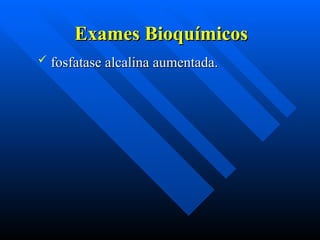 Exames Bioquímicos
Exames Bioquímicos
 fosfatase alcalina aumentada.
fosfatase alcalina aumentada.
 