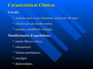 Características Clínicas
Características Clínicas
Gerais:
Gerais:
 acomete mais o sexo feminino, acima dos 40 anos;
acomete mais o sexo feminino, acima dos 40 anos;
 calcificação de tecidos moles;
calcificação de tecidos moles;
 cansaço, sonolência e letargia.
cansaço, sonolência e letargia.
Manifestações Esqueléticas:
Manifestações Esqueléticas:
 osteíte fibrosa cística;
osteíte fibrosa cística;
 osteoporose;
osteoporose;
 fraturas patológicas;
fraturas patológicas;
 ostealgia;
ostealgia;
 deformidades.
deformidades.
 