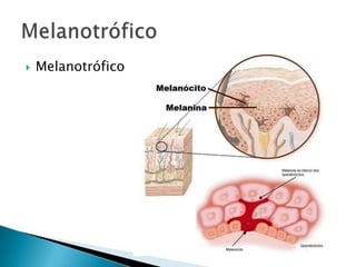    Melanotrófico
 