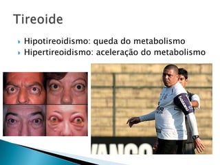    Hipotireoidismo: queda do metabolismo
   Hipertireoidismo: aceleração do metabolismo
 