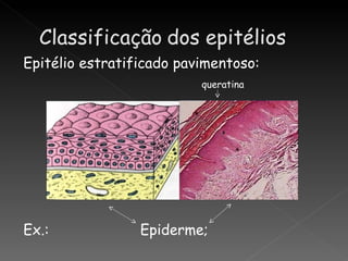 Epitélio estratificado pavimentoso:
                          queratina




Ex.:             Epiderme;
 