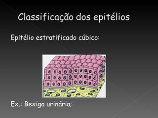 Epitélio estratificado cúbico:




Ex.: Bexiga urinária;
 