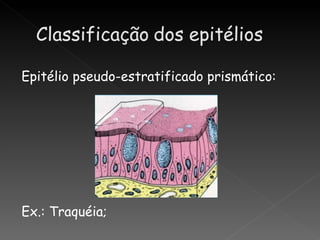 Epitélio pseudo-estratificado prismático:




Ex.: Traquéia;
 
