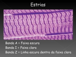 Banda A = Faixa escura
Banda I = Faixa clara
Banda Z = Linha escura dentro da faixa clara
 