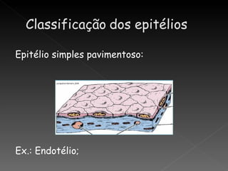 Epitélio simples pavimentoso:




Ex.: Endotélio;
 