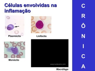 Células envolvidas na inflamação Monócito Macrófago Plasmócito Linfócito C R Ô N I C A 