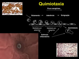 Quimiotaxia 