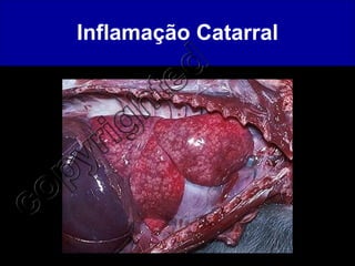 Inflamação Catarral 