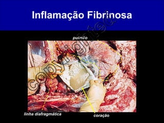 Inflamação Fibrinosa linha diafragmática pulmão coração 
