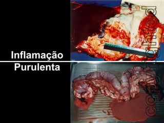 Inflamação Purulenta 