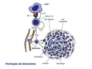 Formação do Granuloma 
