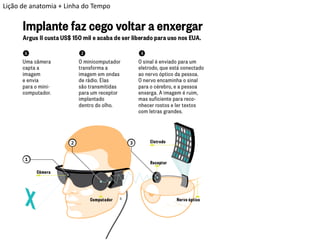 Lição de anatomia + Linha do Tempo  