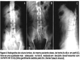 Camada semi-redutora
 