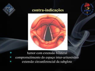 contra-indicações
# tumor com extensão bilateral
# comprometimento do espaço inter-aritenóideo
# extensão circunferencial da subglote
 