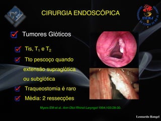 Leonardo Rangel
CIRURGIA ENDOSCÓPICA
Tumores Glóticos
Tis, T1 e T2
Tto pescoço quando
extensão supraglótica
ou subglótica
Traqueostomia é raro
Média: 2 ressecções
Myers EM et al. Ann Otol Rhinol Laryngol 1994;103:28-30.
 