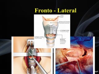 Leonardo Rangel
Fronto - Lateral
 