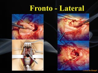 Leonardo Rangel
Fronto - Lateral
 