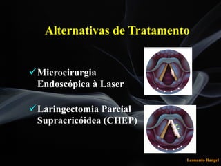 Leonardo Rangel
!Microcirurgia
Endoscópica à Laser 
 
!Laringectomia Parcial
Supracricóidea (CHEP) 
Alternativas de Tratamento
 