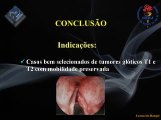 Leonardo Rangel
CONCLUSÃO
! Casos bem selecionados de tumores glóticos T1 e
T2 com mobilidade preservada
Indicações:
 