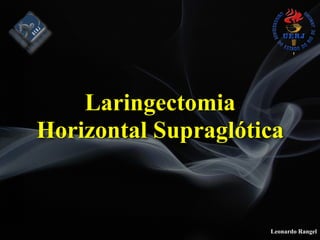 Leonardo Rangel
Laringectomia
Horizontal Supraglótica
 